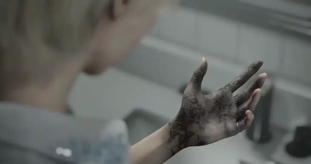 Raccoon City Syndrome